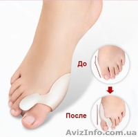 Фиксатор для косточки на ноге Valgus Plus c 50% скидкой!       - <ro>Изображение</ro><ru>Изображение</ru> #1, <ru>Объявление</ru> #1141452