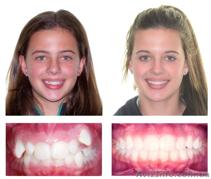 Стоматолог - ортодонт. Постановка брекетов. - <ro>Изображение</ro><ru>Изображение</ru> #2, <ru>Объявление</ru> #1253356